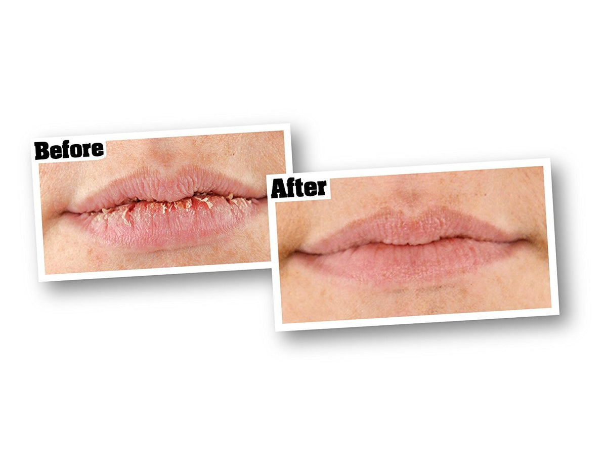 O'Keeffe's® K0710108 Lip Repair® Cooling Relief Lip Balm, Peppermint